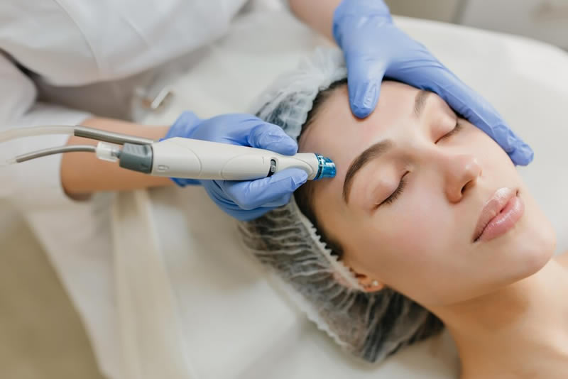 Microneedling